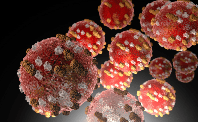 Measles Outbreak and Prevention